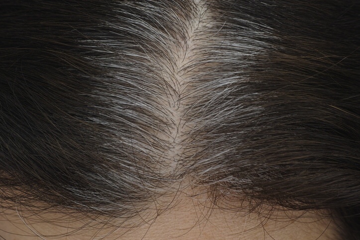 白髪染めは髪の傷みと薄毛の原因 ブログ 銀座美容室カロン銀座 Calon ヘアカラーサロン 白髪染めは髪の傷みと薄毛の原因 ブログ 銀座美容室カロン銀座 Calon ヘアカラーサロン